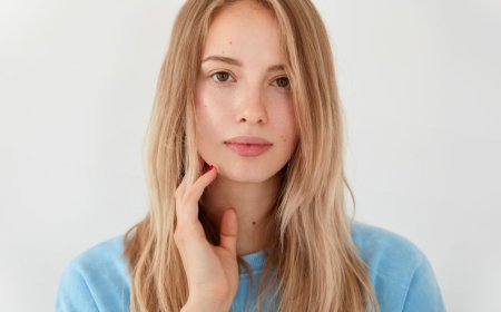 Does Acne Come Back After Isotretinoin?