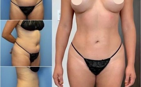 Body Contouring in Dubai: An Investment in Your Appearance
