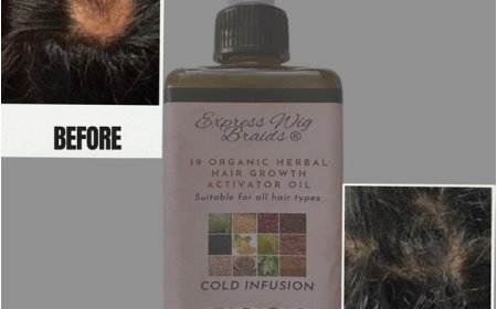 What Are the Benefits of Using Rosemary Oil for Thinning Hair?