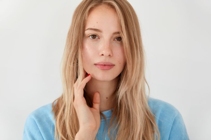 Does Acne Come Back After Isotretinoin?