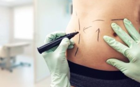 Cost of Abdominoplasty Dubai: What You Should Know in 2025