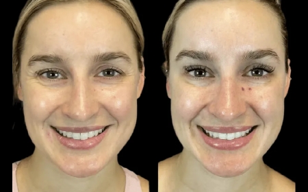 Exploring the Signature Treatments at the Best Aesthetic Clinic in Dubai