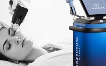 Is Morpheus8 Effective for Treating Old Acne Scars?