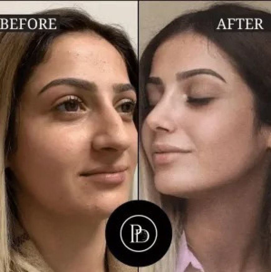 Skin Rejuvenation Starts with PRP Treatment in Dubai
