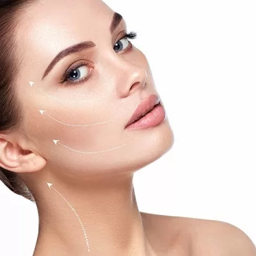 Facial Thread Lift in Dubai: The Best Candidates for a Non-Surgical Facelift