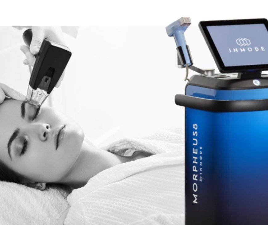 Is Morpheus8 Effective for Treating Old Acne Scars?